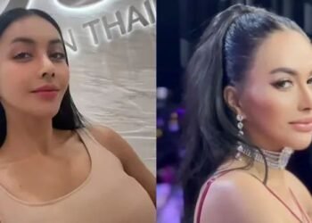 Denada, Oplas, dan Hak Tubuh yang Selalu Diperdebatkan