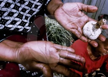 Buruh Kupas Bawang: Upah Kecil, Tangan Jadi Taruhan